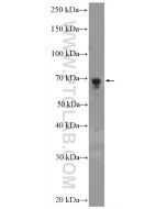 PCK1/2 Polyclonal antibody proteintech 14892-1-AP