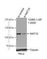 NAT10 Polyclonal antibody proteintech 13365-1-AP