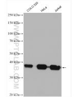 B23/NPM1 Polyclonal antibody proteintech 10306-1-AP