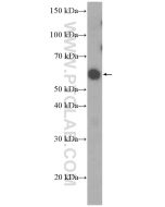 PAX7 Polyclonal antibody proteintech 20570-1-AP
