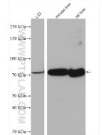 ACSL1 Polyclonal antibody proteintech 13989-1-AP