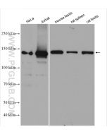 DHX9 Polyclonal antibody proteintech 17721-1-AP