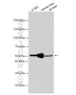 ALDH1A1 Polyclonal antibody proteintech 15910-1-AP