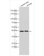 ZFP36 Polyclonal antibody proteintech 12737-1-AP