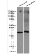 Calponin Polyclonal antibody proteintech 13938-1-AP