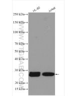 RAB27A Polyclonal antibody proteintech 17817-1-AP