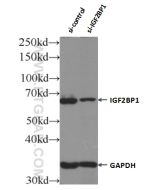 IGF2BP1 Polyclonal antibody proteintech 22803-1-AP