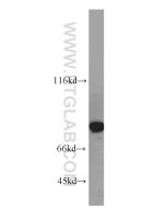 LMOD1 Polyclonal antibody proteintech 15117-1-AP