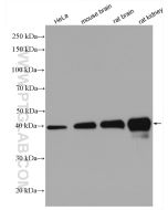 PDH E1 Alpha Polyclonal antibody proteintech 18068-1-AP