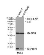 CRABP2 Polyclonal antibody proteintech 10225-1-AP