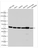 Alpha Tubulin Polyclonal antibody proteintech 14555-1-AP