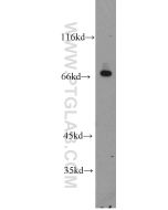 Beta Galactosidase Polyclonal antibody proteintech 15518-1-AP