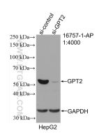GPT2 Polyclonal antibody proteintech 16757-1-AP