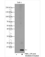 CXCL8/IL-8 Polyclonal antibody proteintech 27095-1-AP