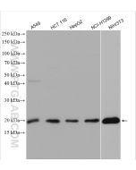 HMGA2 Polyclonal antibody proteintech 20795-1-AP