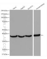 Annexin A2 Polyclonal antibody proteintech 11256-1-AP