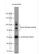 Sodium iodide symporter Polyclonal antibody proteintech 24324-1-AP