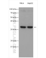 MCU/CCDC109A Polyclonal antibody proteintech 26312-1-AP
