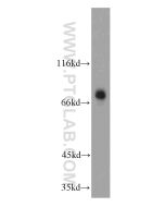 TBR1 Polyclonal antibody proteintech 20932-1-AP