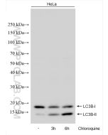 LC3B-Specific Polyclonal antibody proteintech 18725-1-AP