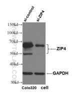 ZIP4 Polyclonal antibody proteintech 20625-1-AP