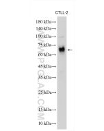 Perforin Polyclonal antibody proteintech 14580-1-AP