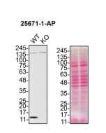 CHCHD10 Polyclonal antibody proteintech 25671-1-AP