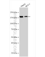 ZO-2 Polyclonal antibody proteintech 18900-1-AP