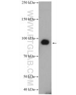 MMP-9 (Middle) Polyclonal antibody proteintech 27306-1-AP