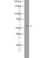 CaMKII Gamma Polyclonal antibody proteintech 12666-2-AP