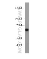 HEPACAM Polyclonal antibody proteintech 18177-1-AP