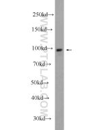 Alpha E-Catenin Polyclonal antibody proteintech 12831-1-AP