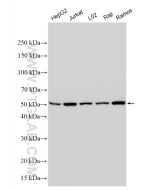 KPNA2 Polyclonal antibody proteintech 10819-1-AP