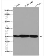 Beta Tubulin Polyclonal antibody proteintech 10094-1-AP