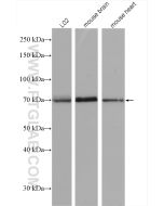 SPHK2 Polyclonal antibody proteintech 17096-1-AP