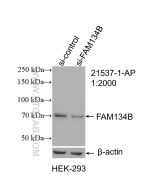FAM134B Polyclonal antibody proteintech 21537-1-AP