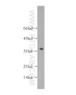 Granzyme B Polyclonal antibody proteintech 13588-1-AP
