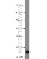 Cardiac Troponin I Polyclonal antibody proteintech 21652-1-AP