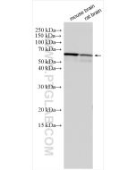 GAD1 Polyclonal antibody proteintech 10408-1-AP