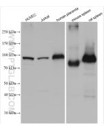 VWF, VWFpp Polyclonal antibody proteintech 11778-1-AP