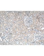 MKS3 Polyclonal antibody proteintech 13975-1-AP