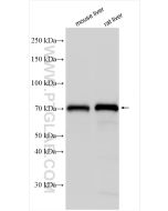 ACSL5 Polyclonal antibody proteintech 15708-1-AP