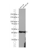 ASS1 Polyclonal antibody proteintech 16210-1-AP