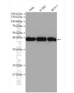 RAD51 Polyclonal antibody proteintech 14961-1-AP