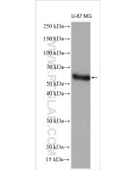 MMP1 Polyclonal antibody proteintech 10371-2-AP