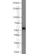 CYP1A1 Polyclonal antibody proteintech 13241-1-AP