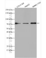 PCSK9 Polyclonal antibody proteintech 55206-1-AP