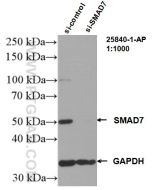 SMAD7 Polyclonal antibody proteintech 25840-1-AP