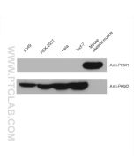 PKM1-specific Polyclonal antibody proteintech 15821-1-AP