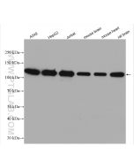 KIF5B Polyclonal antibody proteintech 21632-1-AP